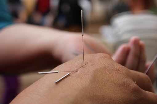 acupunctuur